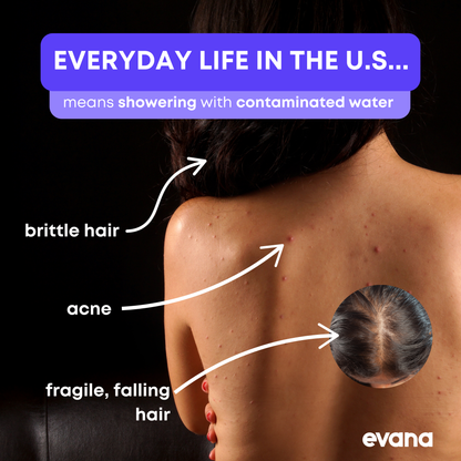 Evana Filtered Shower Head